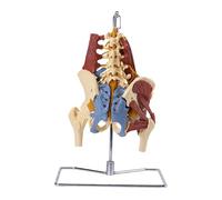 Modèle de colonne lombaire avec hernie discale intervertébrale pour l'éducation médicale, comprend le muscle pelvien unilatéral psoas - aide pédagogique anatomique