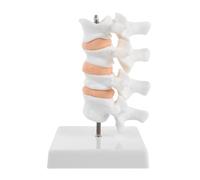 Modèle de Colonne Lombaire en PVC avec Comparaison Ostéoporose | Support Pédagogique Complet, Adapté aux Instructeurs en Gériatrie et Ostéopathie, Usage en Centres de Soins et Cours