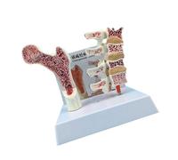 Modèle de colonne vertébrale d'ostéoporose avec squelette anatomique pour enseignement en classe et démonstration clinique Vertèbres squelette anatomique fournitures scolaires
