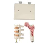 Modèle de Colonne vertébrale d'ostéoporose démontrant Les changements pathologiques visualisés dans Les Tissus vertébraux pour l'enseignement dans Les cabinets médicaux