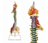 Modèle de Colonne vertébrale Humaine 85 cm Anatomie Musculaire avec Troubles avec Support, modèle de Colonne vertébrale