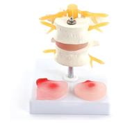 Modèle de Colonne vertébrale Humaine en Deux Sections avec Disque intervertébral Lombaire ; modèle de démonstration Anatomique médical d'une hernie discale Lombaire ; matériel pédagogique.