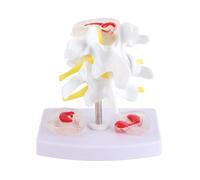 Modèle de Colonne Vertébrale Humaine, Modèle de Démonstration de Hernie Discale Lombaire Fournitures de Formation Scolaire Anatomique de la Colonne Vertébrale Humaine pour