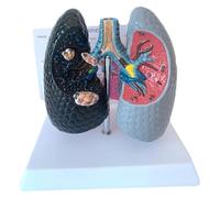 Modèle de comparaison des poumons la santé humaine et du tabagisme, affichage l'anatomie broncho-pulmonaire saine, avec carte arrière en anglais, l'enseignement médical l'éducation à