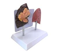 Modèle De Comparaison Détaillé Entre Fumeur Et Poumons Substance En PVC Pour La Formation L'éducation Physique Ensemble De Démonstration En Classe