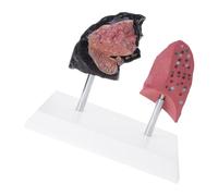 Modèle de comparaison « Puffing Lung vs » pour la formation clinique Structure PVC Permanente Outil pédagogique Comparaison de l'éducation à la santé