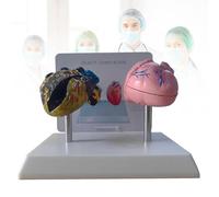 Modèle de cœur de fumeur et modèle de cœur sain présentant des caractéristiques pathologiques et une structure anatomique précise pour démontrer les effets du tabagisme sur la santé cardiaque