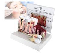 Modèle de dent éducatif d'anatomie Dentaire, modèle de Section transversale des Dents, for l'affichage de la pathologie