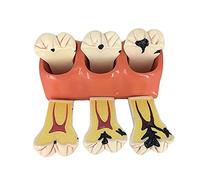 Modèle De Dent, Modèle D'enseignement Oral, Modèle De Décomposition De Carie Détachable 4 Fois, pour Le Mode De Communication Médecin-Patient, Modèle D'enseignement