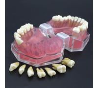 Modèle de dent, moule d'apprentissage entièrement démonté en gomme molle, utilisé pour l'enseignement dentaire ou la communication entre les dentistes et les patients