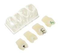 Modèle de Dents D'anatomie Buccale Réaliste en ABS | Texture Réaliste pour Pratique Manuelle, Solide pour Usage Répété, Adapté aux Dentistes et Éducateurs