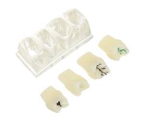 Modèle de Dents D'anatomie Buccale Réaliste en ABS | Texture Réaliste pour Pratique Manuelle, Solide pour Usage Répété, Adapté aux Dentistes et Éducateurs