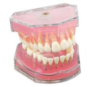 Modèle de dents de typodont avec dents amovibles, modèle pédagogique pour l'enseignement dentaire.