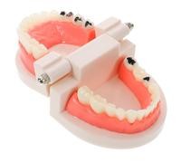 Modèle de Dents Dentaires Amovibles en ABS pour Formation Pratique | Anatomie Réaliste, Composants Détachables et Usage Répété, pour Écoles Dentaires et Conseils Patients