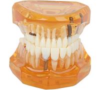 Modèle de Dents dentaires, Fournitures d'étude d'enseignement dentaire pour enfants étude des maladies dentaires modèle d'enseignement des dents enseigner aux enfants se brosser les dents