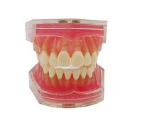 Modèle de Dents dentaires, Modèle de dents amovibles de démonstration d'anatomie dentaire Standard professionnel pour les dentistes, les Patients, les enseignants