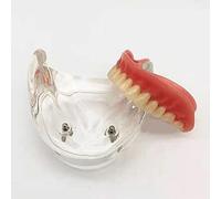 Modèle De Dents Dentaires, Modèle de dents transparentes dentaires, fournitures de démonstration standard de dentiste pour étudier et enseigner