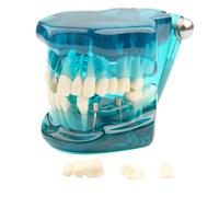 Modèle de dents maladie transparente dentaire d'implant Démonstration d'analyse Dents standard dent d'entraînement typodont avec pont couronne amovible for l'éducation des étudiants (bleu)(Blue)