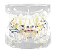 Modèle de dents orthodontiques typodontiques avec supports métalliques et ligatures pour l'enseignement et la pratique