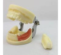 Modèle De Dents Standard, modèle de mâchoire d'implant dentaire, modèle de pratique d'enseignement de la chirurgie buccale, modèle de pratique d'implant