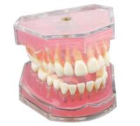 Modèle de dents Typodont avec dents amovibles, outil pédagogique d'étude de modèle dentaire pour étudiants, affichage bureau dentiste, apprentissage du mode dentaire éducatif
