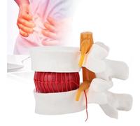 Modèle de disque intervertébral - Grossissement 1,5x - Démonstration de la colonne lombaire pour l'éducation - Détails structurels réalistes