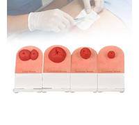 Modèle de formation aux soins de stomie (4 pièces), simulateur de soins infirmiers pour stomie, modèles de soins des plaies pour la pratique des étudiants en médecine, mannequin pédagogique