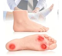 Modèle De Formation Aux Soins des Pieds Diabétiques, Modèle D'ulcère De Lésion Invasive, Conception D'apparence Réaliste Et Amélioration Rapide des Compétences, pour Les Démonstrations