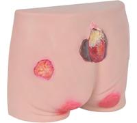 Modèle de formation aux soins des plaies des escarres, escarres avancées | Modèles d'ulcères de pression à différents degrés, modèle de fesses for personnes âgées, for l'éducation des étudiants