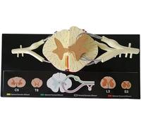Modèle de grossissement 5 fois de la moelle épinière, modèle anatomique du nerf spinal humain, avec description détaillée du produit, utilisé dans la recherche médicale pour la démonstration médicale
