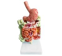 Modèle de l'appareil digestif humain Anatomie de l'estomac Gros intestin Cæcum