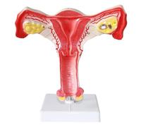 Modèle de lésion utérine avec organes amovibles, modèle d'anatomie génitale féminine 20 cm for une étude précise, support pédagogique