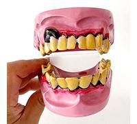 Modèle De Pathologie Buccale, Modèle De Dent Malade du Fumeur Humain, Modèle De Carie Dentaire, Recherche sur Les Maladies Bucco-Dentaires, Enseignement Et Modèle Oral pour l'enseignement