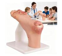 Modèle De Pathologie De L'ulcère Du Pied Diabétique, Simulateur De Soins Infirmiers Hautement Simulé Avec Lésions Purulentes, For Les Démonstrations De Soins(Severe)