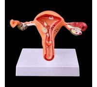 Modèle de pathologie de l'utérus féminin humain Modèle d'anatomie de l'ovaire de l'utérus pathologique féminin humain Modèle d'étude anatomique en coupe transversale