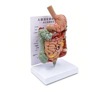 Modèle de pathologie digestive estomac amovible avec carte des maladies