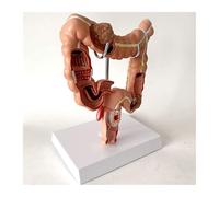 Modèle de pathologie du côlon d'anatomie gros intestin humain