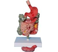 Modèle de pathologie du gros intestin, modèle anatomique de l'estomac humain, section de l'estomac, modèle médical de l'intestin grêle