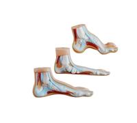 Modèle de pathologie du Pied Pied Normal/Plat/Arc élevé Anatomie avec Muscles et os Affichage pédagogique médical pour l'éducation en podologie