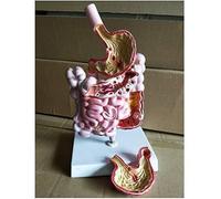Modèle de pathologie gastro-intestinale humaine, modèle d'anatomie l'estomac, d'enseignement