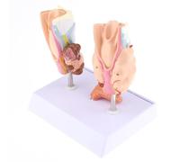 Modèle De Pathologie Thyroïdienne, Modèle De Kyste De Tumeur De La Gorge Thyroïdienne, Modèle D'anatomie Normale Et Pathologique De La Thyroïde Humaine, Enseignement Des Maladies Endocriniennes