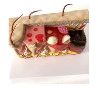 Modèle De Peau Anatomique, Modèle éducatif Peau, Modèle Anatomique Médical De Peau, Modèle De Peau Debrûlure Humaine pour Le Modèle De Taching D'affichage D'étud