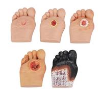 Modèle de Pied diabétique, lésions purulentes de Grade 1 à 5, simulateur de Pied diabétique, Plaque de Pied graduée pour l'anatomie, la physiologie et Les Soins des plaies. Outil de démonstration