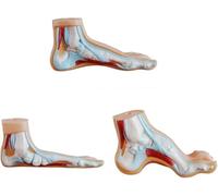 Modèle de pied en 3 parties, modèles d'anatomie pathologique du pied grandeur nature, comprenant pieds plats, pieds creux et pieds normaux, à des fins pédagogiques et d'exposition.