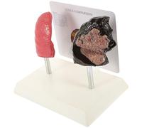 Modèle de Poumon de Fumeur et Sain, Anatomie Pulmonaire PVC | Modèle Pathologique, Enseignement Anatomie et Physiologie, pour Étudiants, Aspect Réaliste, Usage Scolaire