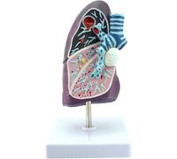 Modèle de poumon pathologique Humain médical Modèle de médecine Interne Modèle de poumon Anatomie pulmonaire Modèle de système respiratoire Modèle Anatomique de poumon Humain