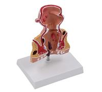 Modèle de rectum pour l ' école de laboratoire, pathologies humaines du rectum, outil d ' enseignement médical d ' anatomie humaine pour l ' anatomie