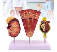 Modèle de Rein, Modèle de Néphron et de Glomérule de Rein Humain, Modèle D'anatomie Rénale pour La Dissection Assistée par L'éducation Médicale Adaptée