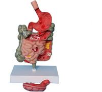 Modèle de section du tube digestif avec estomac amovible | Modèle d'anatomie pathologique de l'estomac et de l'intestin humain, outil de démonstration des lésions gastriques