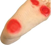 Modèle de simulateur de soins infirmiers for les pieds diabétiques, modèle de soins des pieds diabétiques, 3 ulcères, modèle avancé de soins de physiologie des pieds diabétiques, outil